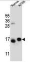 Eukaryotic Translation Initiation Factor 5A Like 1 antibody, AP51404PU-N, Origene, Western Blot image 