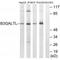 Beta 3-Glucosyltransferase antibody, A12523, Boster Biological Technology, Western Blot image 