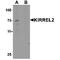 Kirre Like Nephrin Family Adhesion Molecule 2 antibody, TA349102, Origene, Western Blot image 