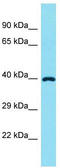 Fatty Acid Desaturase 6 antibody, TA335357, Origene, Western Blot image 