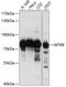 5-Methyltetrahydrofolate-Homocysteine Methyltransferase Reductase antibody, 15-635, ProSci, Western Blot image 
