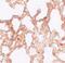 Zinc Finger MYM-Type Containing 1 antibody, PA5-21089, Invitrogen Antibodies, Immunohistochemistry frozen image 