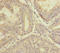 P-LAP antibody, LS-C676272, Lifespan Biosciences, Immunohistochemistry paraffin image 