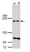 Kinase D-interacting substrate of 220 kDa antibody, PA5-22116, Invitrogen Antibodies, Western Blot image 