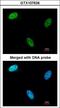 Deoxycytidine kinase antibody, LS-B10837, Lifespan Biosciences, Immunocytochemistry image 