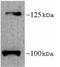 Leptin Receptor antibody, ab5593, Abcam, Western Blot image 