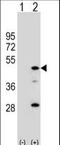 Arylacetamide Deacetylase antibody, LS-C155827, Lifespan Biosciences, Western Blot image 