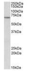 Electron transfer flavoprotein-ubiquinone oxidoreductase, mitochondrial antibody, orb20595, Biorbyt, Western Blot image 