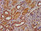 Decaprenyl Diphosphate Synthase Subunit 2 antibody, LS-C673538, Lifespan Biosciences, Immunohistochemistry paraffin image 
