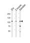 Cytosolic carboxypeptidase 2 antibody, PA5-72669, Invitrogen Antibodies, Western Blot image 