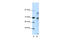 Nuclear Receptor Corepressor 2 antibody, 27-605, ProSci, Western Blot image 