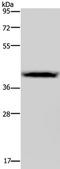Colony Stimulating Factor 2 Receptor Alpha Subunit antibody, TA323988, Origene, Western Blot image 