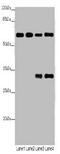 Phosphoglucomutase-1 antibody, A50408-100, Epigentek, Western Blot image 
