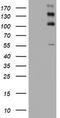 ALK Receptor Tyrosine Kinase antibody, TA801305, Origene, Western Blot image 