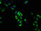 V-Set Domain Containing T Cell Activation Inhibitor 1 antibody, LS-B11251, Lifespan Biosciences, Immunofluorescence image 