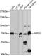 SAT antibody, GTX66205, GeneTex, Western Blot image 