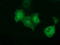 Peroxisomal Trans-2-Enoyl-CoA Reductase antibody, LS-C115675, Lifespan Biosciences, Immunofluorescence image 