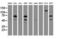 Receptor Interacting Serine/Threonine Kinase 1 antibody, LS-C175236, Lifespan Biosciences, Western Blot image 