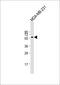 One Cut Homeobox 3 antibody, 59-624, ProSci, Western Blot image 