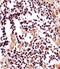 IZUMO Family Member 2 antibody, A17024, Boster Biological Technology, Immunohistochemistry paraffin image 