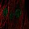 Chromosome 22 Open Reading Frame 23 antibody, NBP2-76489, Novus Biologicals, Immunofluorescence image 