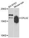 Complexin 2 antibody, A7774, ABclonal Technology, Western Blot image 