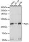 Phospholipase D1 antibody, 15-865, ProSci, Western Blot image 