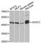 Vascular Endothelial Growth Factor C antibody, MBS126534, MyBioSource, Western Blot image 