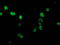 SSX Family Member 1 antibody, TA502726, Origene, Immunofluorescence image 