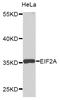 Sister chromatid cohesion protein PDS5 homolog B antibody, STJ23502, St John