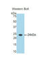 Retinol Binding Protein 5 antibody, LS-C296252, Lifespan Biosciences, Western Blot image 