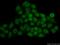 Signal transducer and activator of transcription 1 antibody, 10144-2-AP, Proteintech Group, Immunofluorescence image 