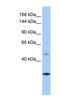 Calmin antibody, NBP1-91450, Novus Biologicals, Western Blot image 