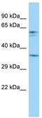 Peroxisomal Biogenesis Factor 12 antibody, TA329556, Origene, Western Blot image 