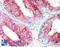 Keratin 8 antibody, LS-B11560, Lifespan Biosciences, Immunohistochemistry paraffin image 