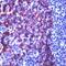 Keratin 5 antibody, PA1-37974, Invitrogen Antibodies, Immunohistochemistry paraffin image 