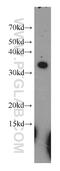 Ribosomal Protein L7a antibody, 15340-1-AP, Proteintech Group, Western Blot image 