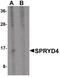 SPRY Domain Containing 4 antibody, PA5-21174, Invitrogen Antibodies, Western Blot image 