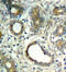 PTPN11 antibody, abx000486, Abbexa, Immunohistochemistry paraffin image 