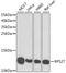 Ribosomal Protein S27 antibody, STJ28812, St John
