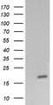 Cancer/Testis Antigen 1B antibody, TA505967BM, Origene, Western Blot image 