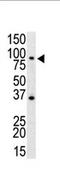Toll Like Receptor 4 antibody, AP11532PU-N, Origene, Western Blot image 