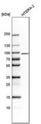 Stonin-1 antibody, PA5-52190, Invitrogen Antibodies, Western Blot image 