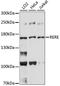 Arginine-Glutamic Acid Dipeptide Repeats antibody, A07605, Boster Biological Technology, Western Blot image 