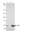 LYN Proto-Oncogene, Src Family Tyrosine Kinase antibody, NBP2-17189, Novus Biologicals, Immunoprecipitation image 