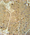 Alcohol Dehydrogenase 1C (Class I), Gamma Polypeptide antibody, LS-C156086, Lifespan Biosciences, Immunohistochemistry paraffin image 