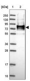 Uncharacterized protein C10orf131 antibody, NBP2-30772, Novus Biologicals, Immunohistochemistry paraffin image 