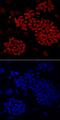 Zinc Finger Protein 281 antibody, MAB6350, R&D Systems, Immunocytochemistry image 
