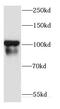 Cadherin-18 antibody, FNab01186, FineTest, Western Blot image 