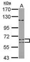 Adenosine Deaminase Domain Containing 1 antibody, PA5-31845, Invitrogen Antibodies, Western Blot image 